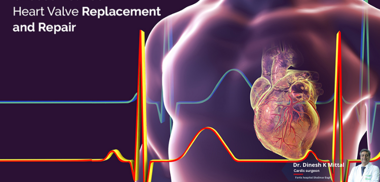 Is-Heart-Valve-Repair-or-Replacement-a-Major-Surgery.png