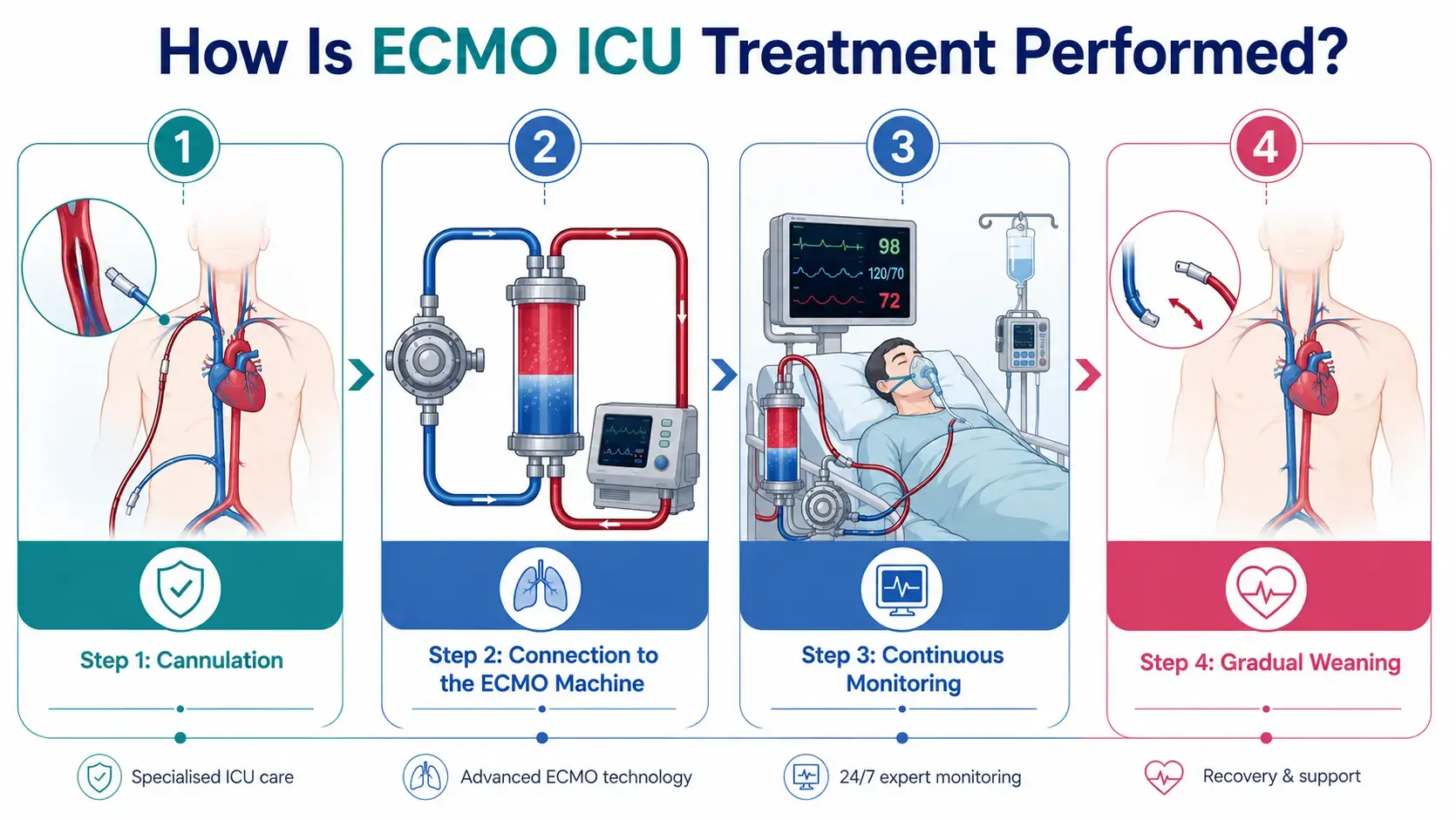 ECMO treatment in Delhi NCR. Best doctor for ECMO in delhi 
