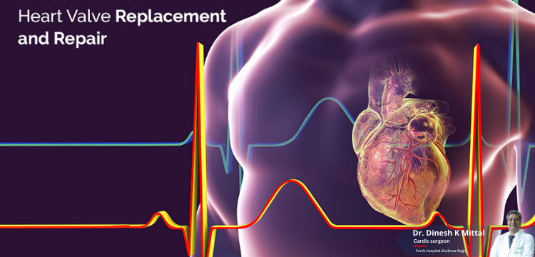 Is Heart Valve Repair or Replacement a Major Surgery? – Dr. Dinesh Mittal