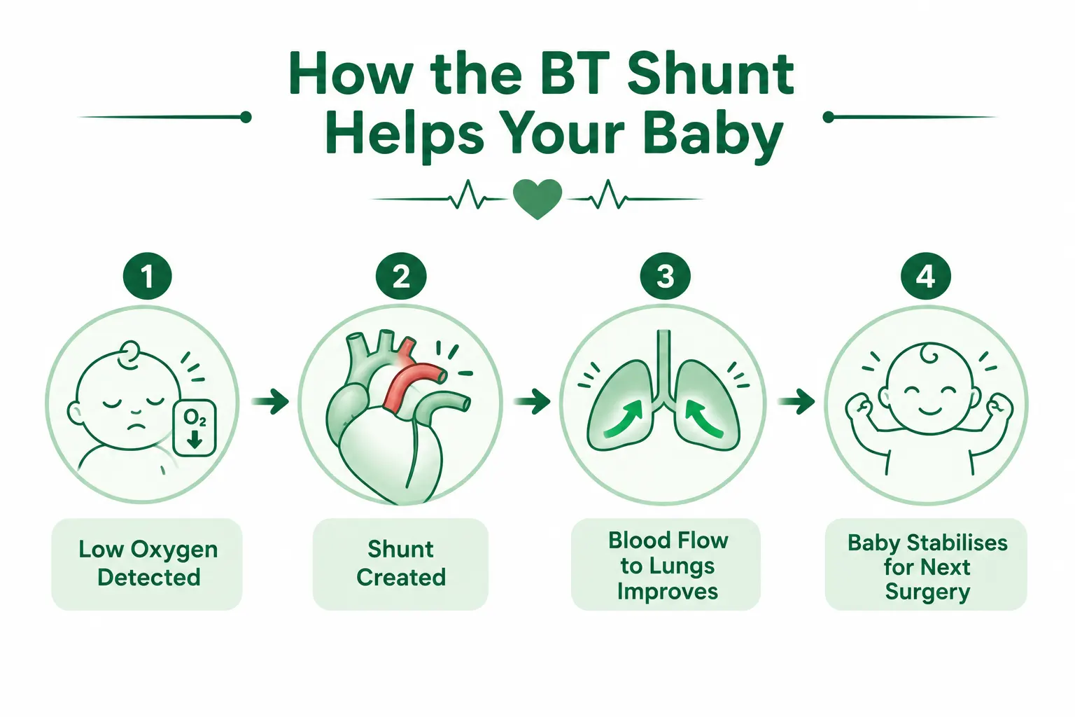 Infographic showing four stages of how a BT shunt improves oxygen flow in infants with congenital heart defects.
