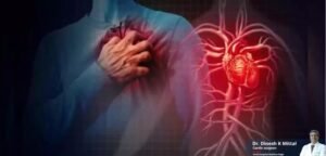 Understanding Heart Failure Surgery: What are the Procedures, Risks, and Costs Involved?