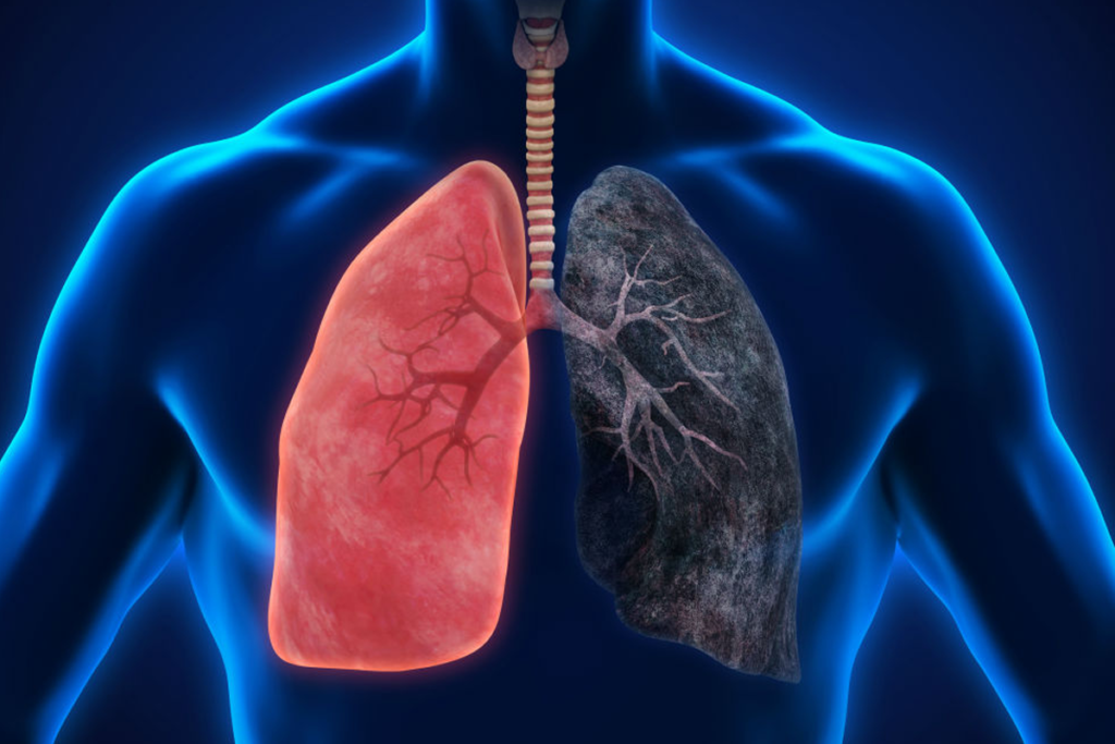 How Quitting Smoking Benefits Your Lung and Heart Health?