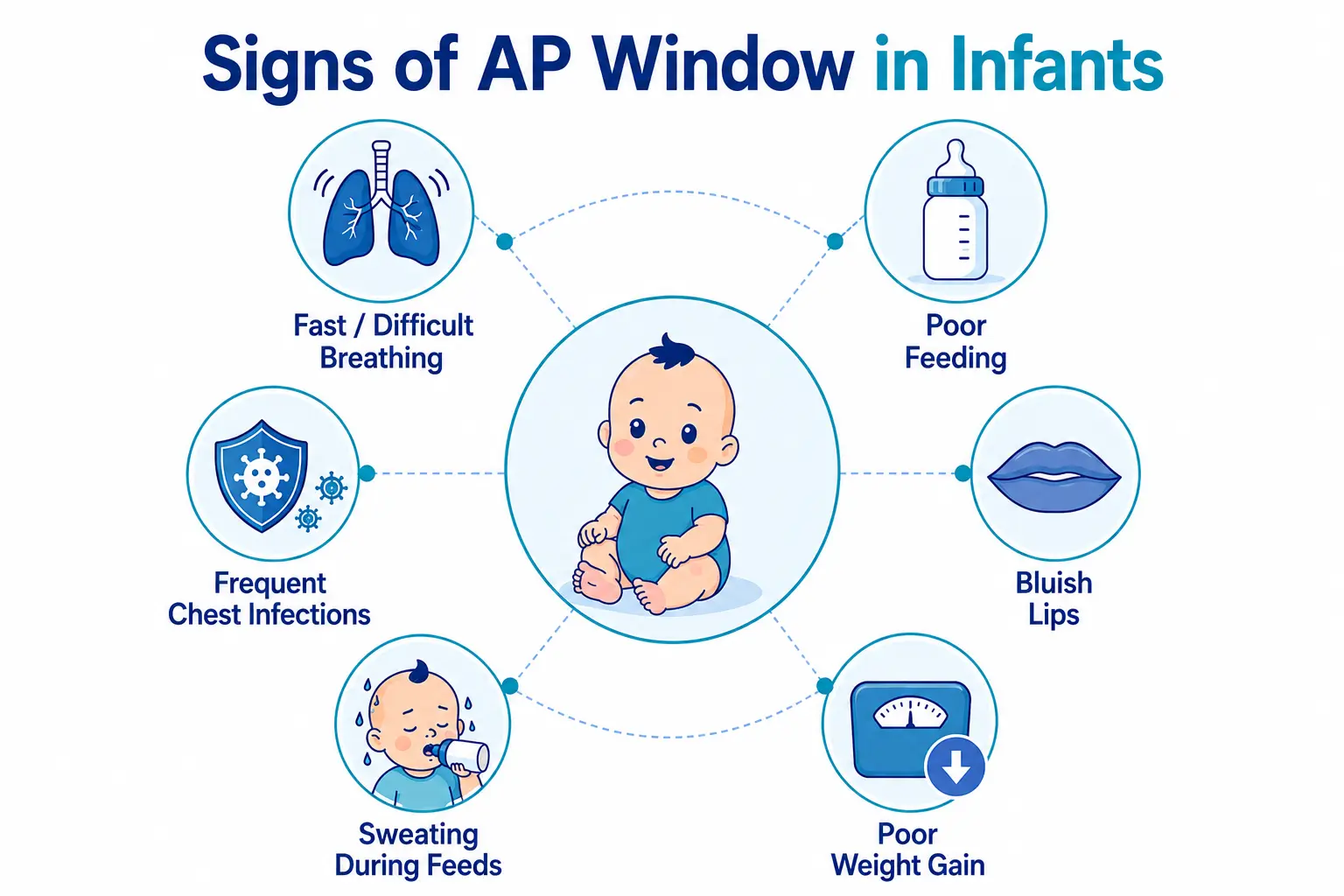 AP Window signs and symptoms