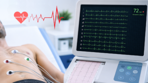 ECG Test: What It Measures and Why It Matters?