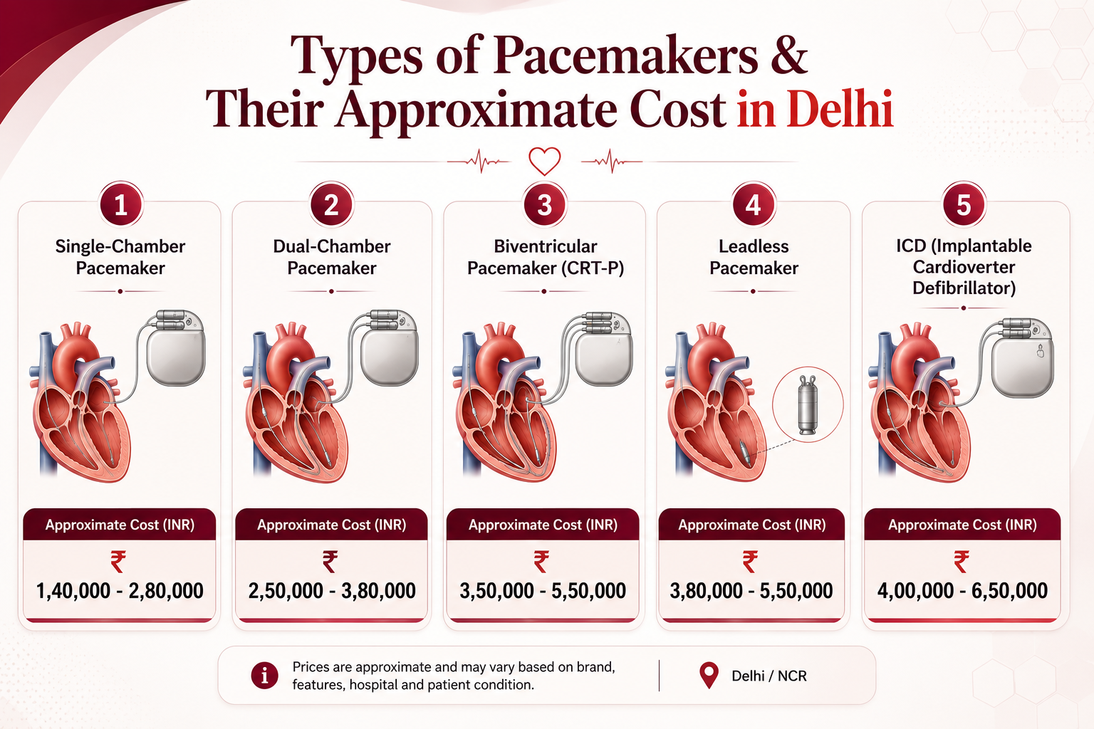 Types of Pacemakers & Their Approximate Cost in Delhi