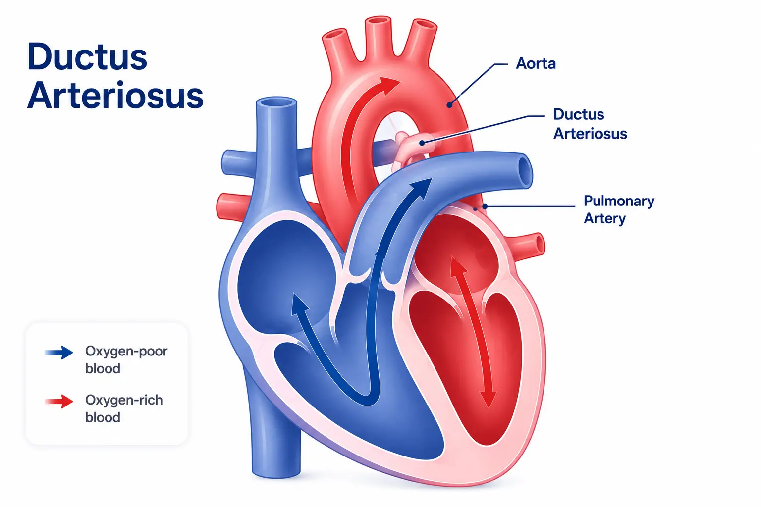 PDA Ligation Surgery in Delhi