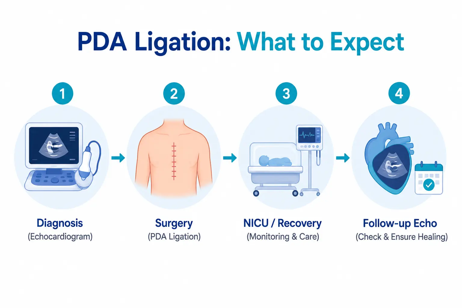 PDA Ligation complete procedure