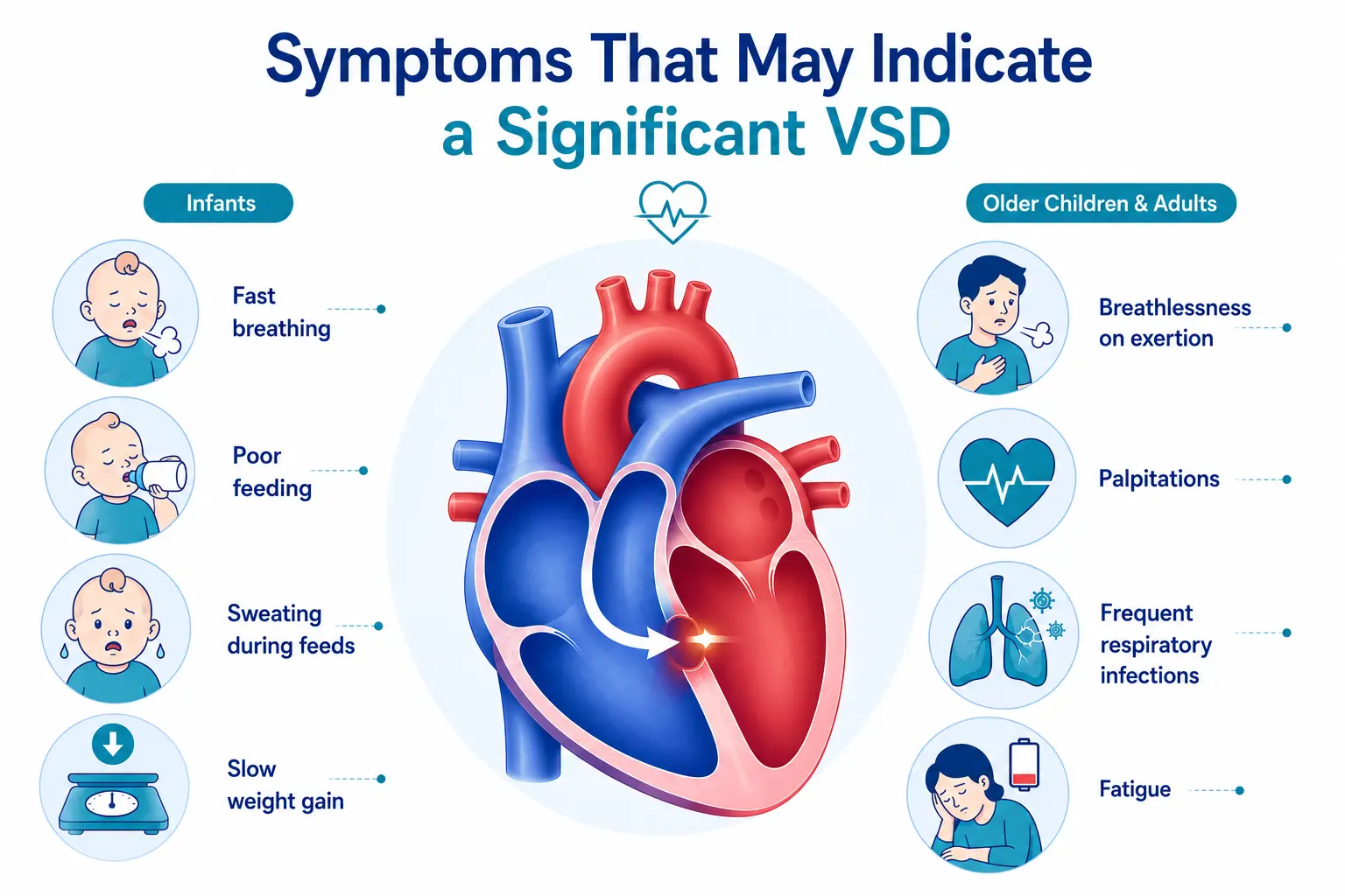 Symptoms of VSD (Ventricu)lar Septal Defect