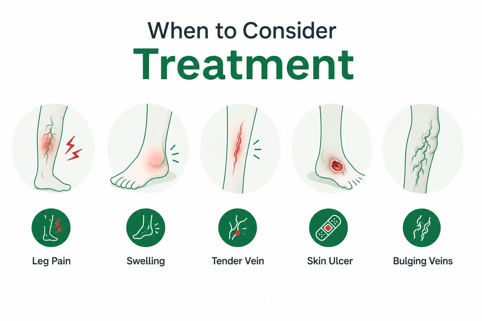 When to consider Varicose Treatment in Delhi. Best CTVS surgeon in Delhi.