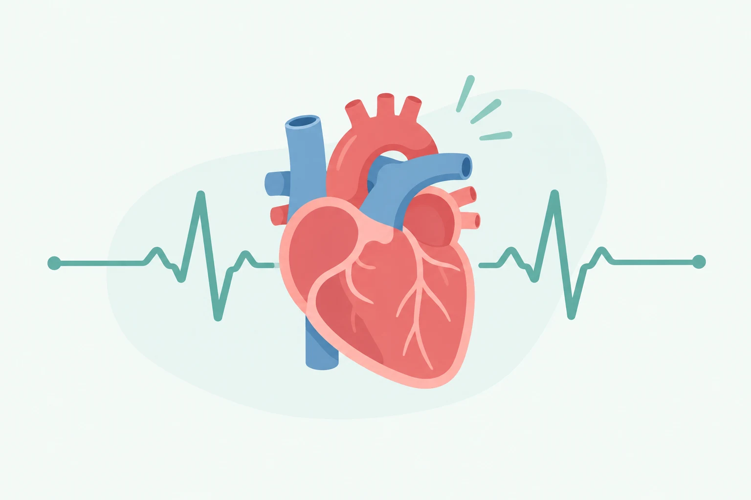 Arrhythmia Treatment in Delhi