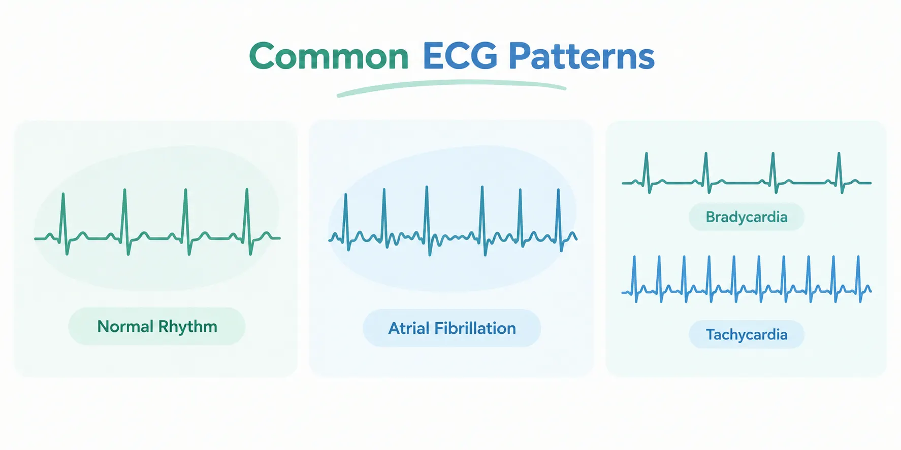 Common ECG patterns. Arrhythmia Treatment.